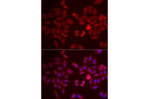 Immunofluorescence analysis of U2OS cells using PDK4 antibody (ABIN5971569).