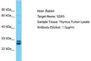 Host:  Rabbit  Target Name:  SSX5  Sample Type:  Thymus Tumor lysates  Antibody Dilution:  1. (SSX5 antibody  (C-Term))