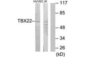 Western blot analysis of extracts from Jurkat/HuvEc cells, using TBX22 Antibody. (T-Box 22 antibody  (AA 1-50))
