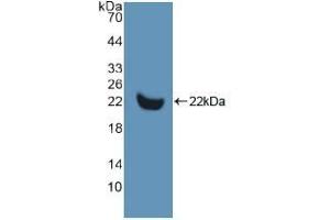 Detection of Recombinant MMP13, Human using Polyclonal Antibody to Matrix Metalloproteinase 13 (MMP13) (MMP13 antibody  (AA 290-468))