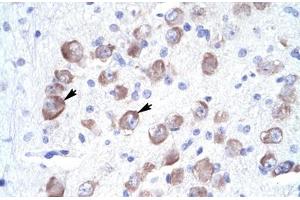 Immunohistochemical staining (Formalin-fixed paraffin-embedded sections) of human brain with LARP1 polyclonal antibody . (LARP1 antibody  (AA 701-750))