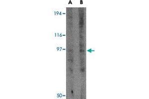 Western blot analysis of GRIK3 in human brain tissue lysate with GRIK3 polyclonal antibody  at (A) 1 and (B) 2 ug/mL . (GRIK3 antibody  (N-Term))