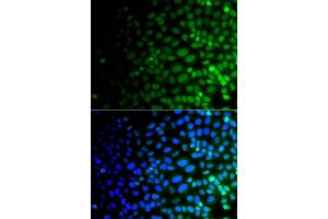 Immunofluorescence analysis of A549 cells using ULK4 antibody. (ULK4 antibody)