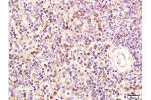 Formalin-fixed and paraffin embedded human spleen labeled with Anti- Fc ? (Fc epsilon RI/FCER1A antibody  (AA 101-220))