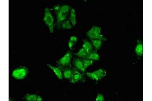Immunofluorescence (IF) image for anti-Ribosomal Protein S6 Kinase, 90kDa, Polypeptide 1 (RPS6KA1) (AA 233-400) antibody (ABIN7168172)