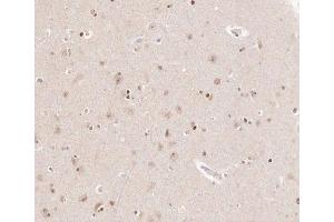 ABIN6266905 at 1/100 staining human brain tissue sections by IHC-P. (CKS2 antibody  (Internal Region))