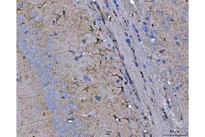 IHC analysis of Septin 2/SEPTIN2 using anti-Septin 2/SEPTIN2 antibody (ABIN7599275).