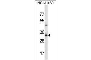 Western blot analysis in NCI-H460 cell line lysates (35ug/lane). (TBC1D21 antibody  (N-Term))