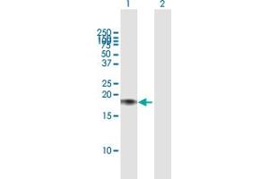 Western Blot analysis of CALM2 expression in transfected 293T cell line by CALM2 MaxPab polyclonal antibody. (Calmodulin 2 antibody  (AA 1-149))