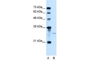 Sonic Hedgehog antibody used at 1 ug/ml to detect target protein. (Sonic Hedgehog antibody)