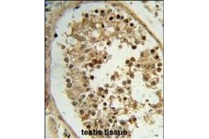 Formalin-fixed and paraffin-embedded human testis tissue reacted with ELOVL2 Antibody (N-term), which was peroxidase-conjugated to the secondary antibody, followed by DAB staining. (ELOVL2 antibody  (N-Term))