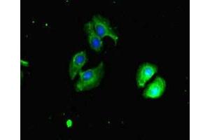 Immunofluorescent analysis of A549 cells using ABIN7147720 at dilution of 1:100 and Alexa Fluor 488-congugated AffiniPure Goat Anti-Rabbit IgG(H+L) (CHD4 antibody  (AA 1-219))