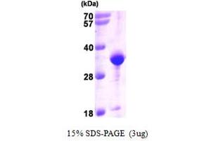 SDS-PAGE (SDS) image for VAMP (Vesicle-Associated Membrane Protein)-Associated Protein A, 33kDa (VAPA) (AA 1-227) protein (His tag) (ABIN666942) (VAPA Protein (AA 1-227) (His tag))