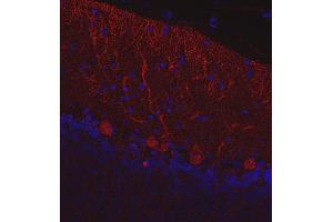 Immunohistochemistry (Paraffin-embedded Sections) (IHC (p)) image for anti-Calbindin (CALB1) (AA 3-251) antibody (ABIN1742425)