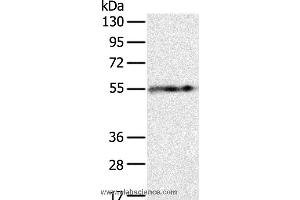 Western blot analysis of Human fat tissue, using PLIN1 Polyclonal Antibody at dilution of 1:250 (PLIN1 antibody)