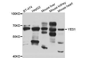 Western blot analysis of extracts of various cell lines, using YES1 antibody (ABIN5974700) at 1/1000 dilution. (YES1 antibody)