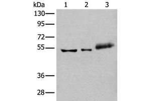 Western blot analysis of Hela cell Mouse kidney tissue and Human colorectal cancer tissue lysates using YY2 Polyclonal Antibody at dilution of 1:800 (YY2 antibody)