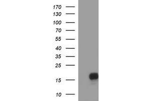 Image no. 1 for anti-SIVA1, Apoptosis-Inducing Factor (SIVA1) antibody (ABIN1500939) (SIVA1 antibody)