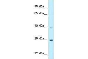 WB Suggested Anti-DNAJC9 Antibody Titration: 1. (DNAJC9 antibody  (C-Term))
