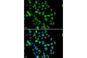 Immunofluorescence analysis of U20S cell using STAMBP antibody. (STAMBP antibody)