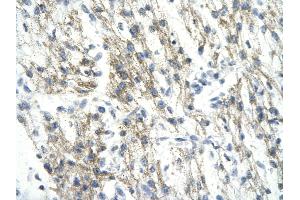 Rabbit Anti-RUVBL1 antibody   Paraffin Embedded Tissue: Human Heart cell Cellular Data: cardiac cell of renal tubule Antibody Concentration: 4. (RUVBL1 antibody  (N-Term))