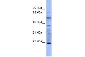 MYL3 antibody used at 1 ug/ml to detect target protein. (MYL3/CMLC1 antibody  (N-Term))