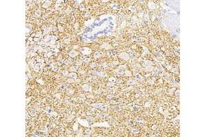 Immunohistochemistry analysis of paraffin-embedded mouse spinal cord using,KCC2 (ABIN7075650) at dilution of 1: 1800 (KCC2 antibody)