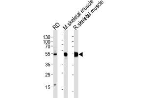 Western Blotting (WB) image for anti-Enolase 3 (Beta, Muscle) (ENO3) antibody (ABIN3001691)