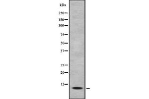Western blot analysis of MK1I1 expression in HEK293 cells ,The lane on the left is treated with the antigen-specific peptide. (MAPKSP1 antibody  (Internal Region))