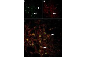 Multiplex staining of VMAT2 and TRPC3 in rat brain - Immunohistochemical staining of perfusion-fixed frozen rat substantia nigra sections using Anti-VMAT2-ATTO Fluor-488 Antibody (ABIN7043689), (1:60) and Anti-TRPC3-ATTO Fluor-594 Antibody (ABIN7043819), (1:60). (SLC18A2 antibody  (1st Lumenal Region) (Atto 488))