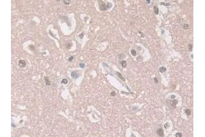 Detection of GUCY1b3 in Human Cerebrum Tissue using Polyclonal Antibody to Guanylate Cyclase 1 Beta 3 (GUCY1b3) (GUCY1B3 antibody  (AA 408-619))