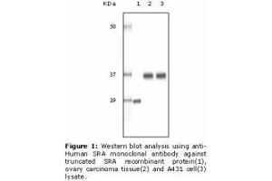 Image no. 2 for anti-Steroid Receptor RNA Activator 1 (SRA1) antibody (ABIN232101) (SRA1 antibody)