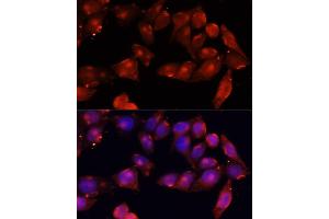 Immunofluorescence analysis of HeLa cells using B antibody (ABIN7265414) at dilution of 1:100 (40x lens). (ACVR2B antibody  (AA 50-150))