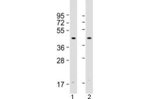 Western blot testing of human 1) HeLa and 2) Jurkat cell lysate with Atrogin 1 antibody at 1:2000. (FBXO32 antibody  (AA 17-49))