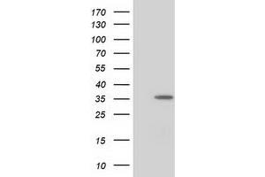 Western Blotting (WB) image for anti-Nudix (Nucleoside Diphosphate Linked Moiety X)-Type Motif 6 (NUDT6) antibody (ABIN1499872) (NUDT6 antibody)