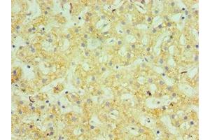 Immunohistochemistry of paraffin-embedded human liver tissue using ABIN7145505 at dilution of 1:100 (Glucuronidase beta antibody  (AA 382-651))
