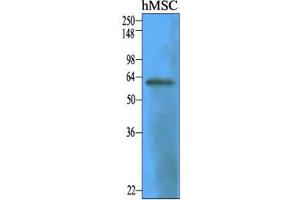 Western Blotting (WB) image for anti-5'-Nucleotidase, Ecto (CD73) (NT5E) antibody (ABIN361024) (CD73 antibody)