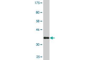 Western Blot detection against Immunogen (36. (FZD4 antibody  (AA 107-206))