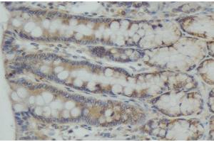 ABIN6274989 at 1/100 staining human colon carcinoma tissue sections by IHC-P. (CEP55 antibody  (C-Term))