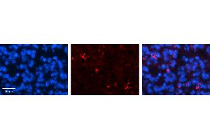 CRSP9 antibody - N-terminal region          Formalin Fixed Paraffin Embedded Tissue:  Human Pineal Tissue    Observed Staining:  Cytoplasm and nuclear membrane in Human Pineal Tissue   Primary Antibody Concentration:  1:100    Secondary Antibody:  Donkey anti-Rabbit-Cy3    Secondary Antibody Concentration:  1:200    Magnification:  20X    Exposure Time:  0. (MED7 antibody  (N-Term))