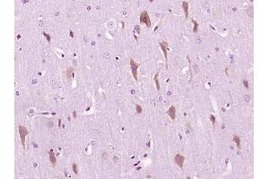 Paraformaldehyde-fixed, paraffin embedded Rat brain Antigen retrieval by boiling in sodium citrate buffer (pH6. (ERN1 antibody  (AA 252-260))