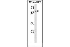 Western blot analysis of XRCC9 / FANCG Antibody (C-term) in MDA-MB453 cell line lysates (35ug/lane). (FANCG antibody  (C-Term))