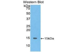 Western blot analysis of the recombinant protein. (SH2D1A antibody  (AA 18-115))