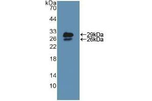Western blot analysis of recombinant Mouse NUP85. (NUP85 antibody  (AA 418-653))