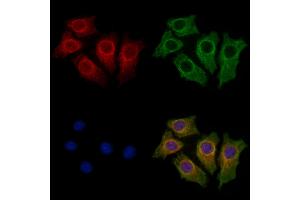 anti-Trichohyalin (TCHH) (C-Term) antibody