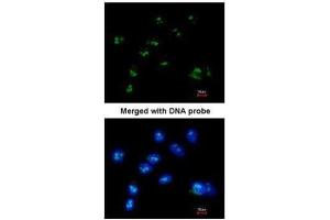ICC/IF Image Immunofluorescence analysis of paraformaldehyde-fixed A549, using RASSF2, antibody at 1:200 dilution. (RASSF2 antibody  (Center))