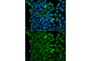 Immunofluorescence analysis of A549 cell using RNF125 antibody. (RNF125 antibody)