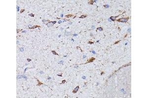 Immunohistochemistry of paraffin-embedded Rat brain using AVP Polyclonal Antibody at dilution of 1:100 (40x lens). (Vasopressin antibody)
