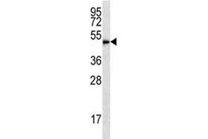 HDAC3 antibody western blot analysis in HL-60 lysate (HDAC3 antibody  (AA 383-412))