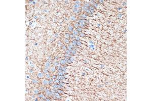 Immunohistochemistry of paraffin-embedded rat brain using Alpha Internexin Rabbit mAb (ABIN7268012) at dilution of 1:100 (40x lens). (INA antibody)